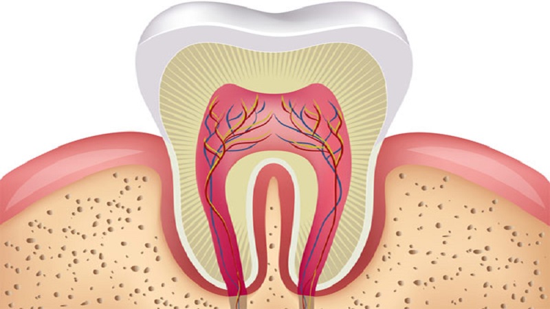 درمان دندان 