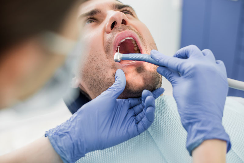 درمان کیست دندانی