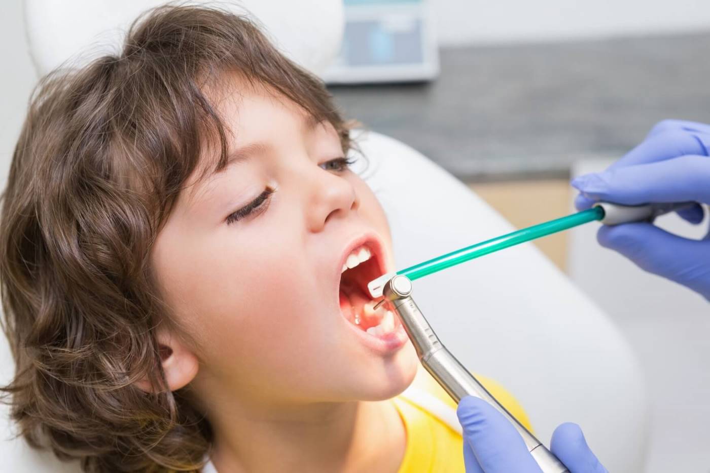 تاثیر تغذیه بر کیفیت دندان کودک