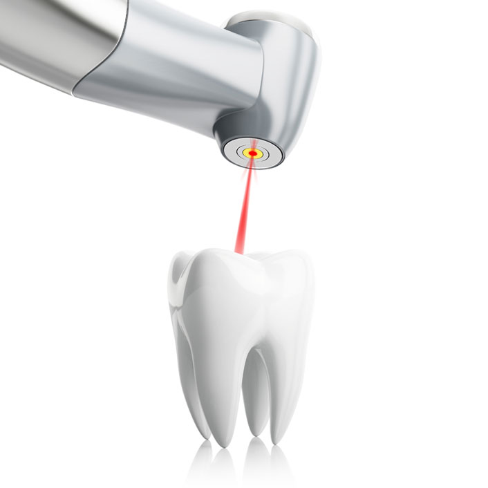 روش جدید لیزر برای درمان ریشه دندان