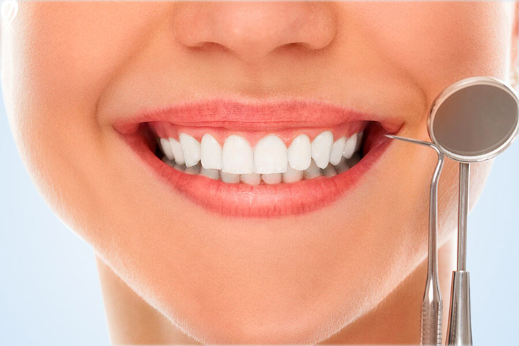 جرم گیری دندان را سفیدتر می کند یا بلیچینگ