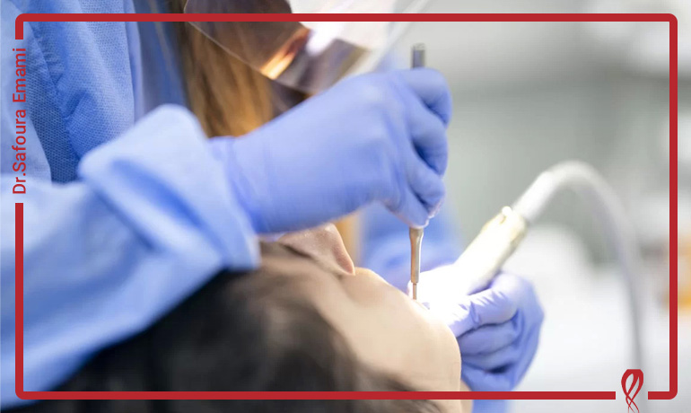 فرق درمان ریشه دندان با عصب کشی چیست؟