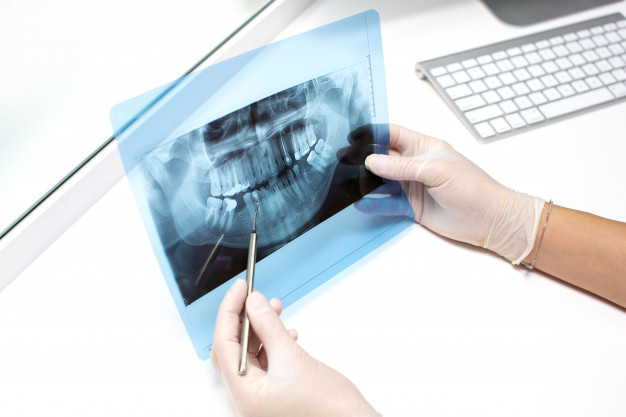 رادیوگرافی‌های دندانی