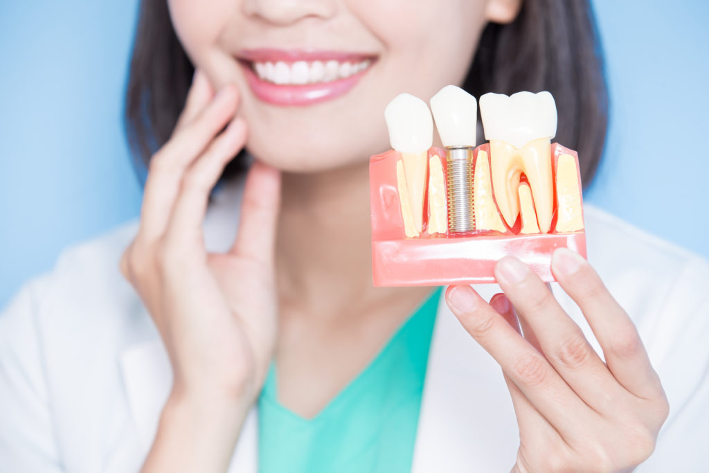 متخصص عصب کشی دندان